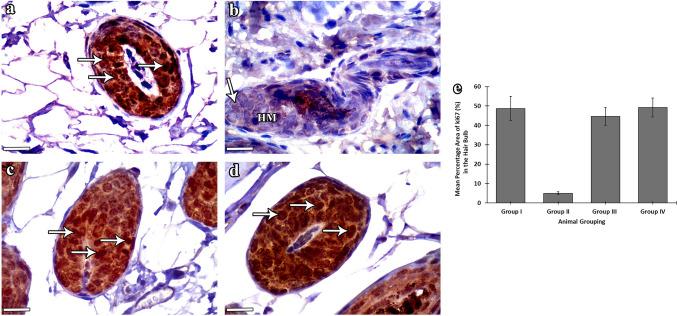 https://cdn.ncbi.nlm.nih.gov/pmc/blobs/ffe5/11162382/680ce15e3308/418_2024_2282_Fig8_HTML.jpg