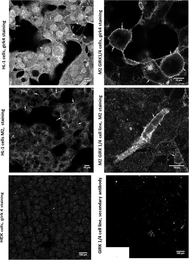 https://cdn.ncbi.nlm.nih.gov/pmc/blobs/ffe7/2872014/438306ff2ae1/424_2010_799_Fig5_HTML.jpg