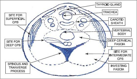 https://cdn.ncbi.nlm.nih.gov/pmc/blobs/ffe8/4024695/26289b2756f6/SJA-8-290-g004.jpg
