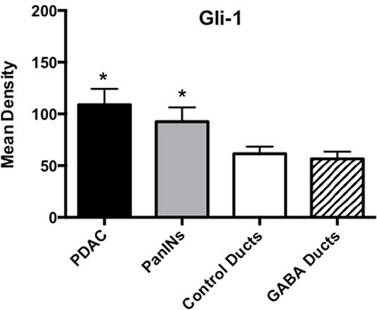 https://cdn.ncbi.nlm.nih.gov/pmc/blobs/fff1/5190108/46d5a16488ea/oncotarget-07-44430-g009.jpg