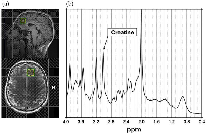https://cdn.ncbi.nlm.nih.gov/pmc/blobs/fff4/8652356/c34f83281066/10.1177_02698811211050550-fig1.jpg