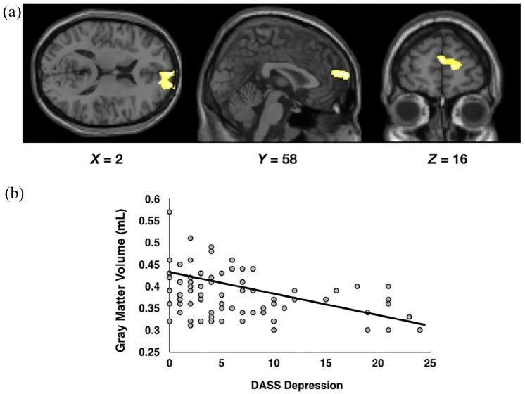 https://cdn.ncbi.nlm.nih.gov/pmc/blobs/fff4/8652356/ff0cf531c6ec/10.1177_02698811211050550-fig3.jpg