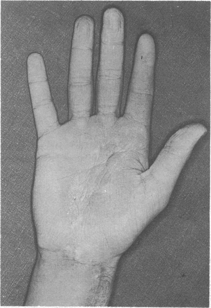 https://cdn.ncbi.nlm.nih.gov/pmc/blobs/fff5/1586870/4af210f74d82/brmedj01576-0025-b.jpg