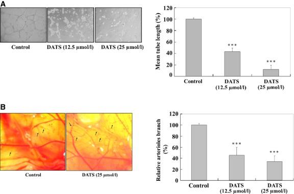 https://cdn.ncbi.nlm.nih.gov/pmc/blobs/fff5/4407594/0696ef5269dd/jcmm0019-0474-f6.jpg