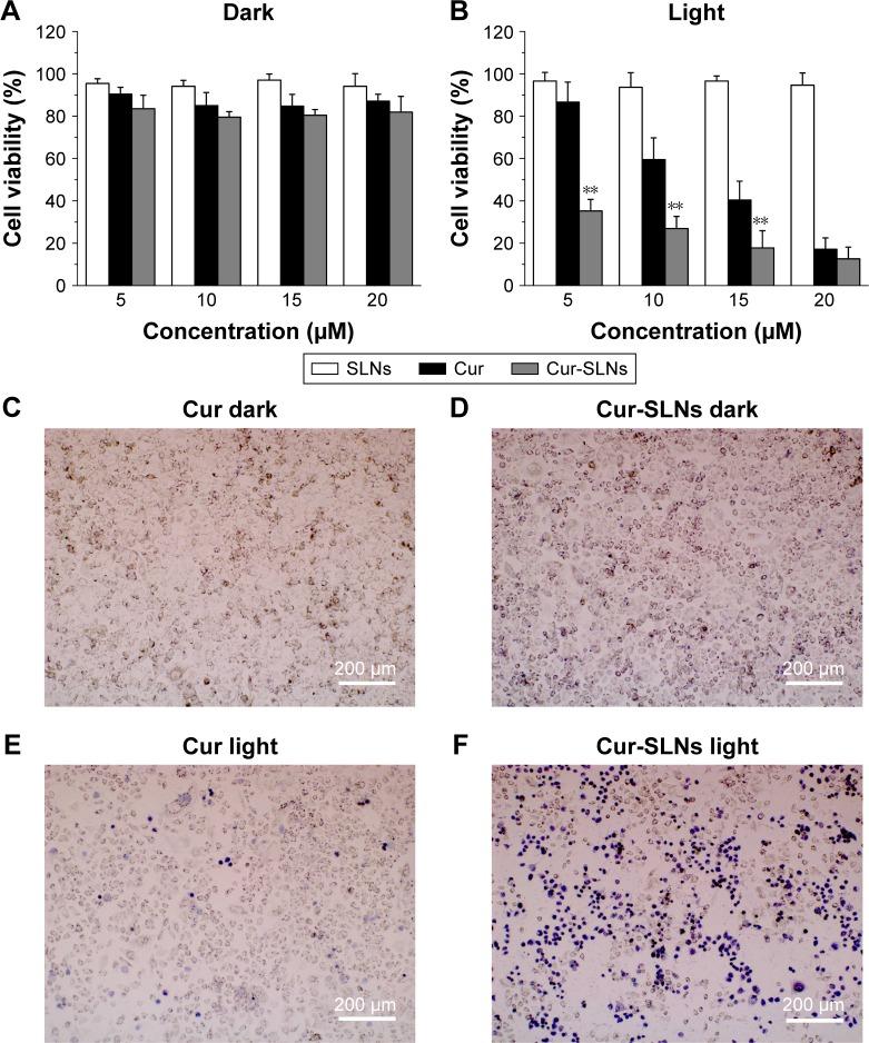 https://cdn.ncbi.nlm.nih.gov/pmc/blobs/fff7/5191853/417a6f03813d/ijn-12-167Fig2.jpg