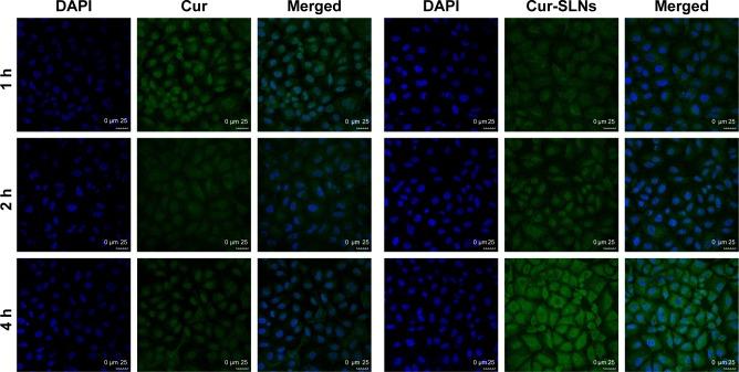 https://cdn.ncbi.nlm.nih.gov/pmc/blobs/fff7/5191853/6b73ff9aa782/ijn-12-167Fig5.jpg