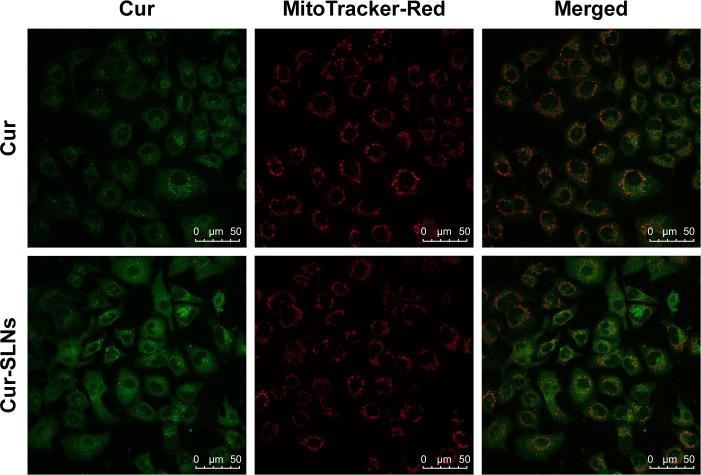 https://cdn.ncbi.nlm.nih.gov/pmc/blobs/fff7/5191853/9caa37ef2e9c/ijn-12-167Fig6.jpg