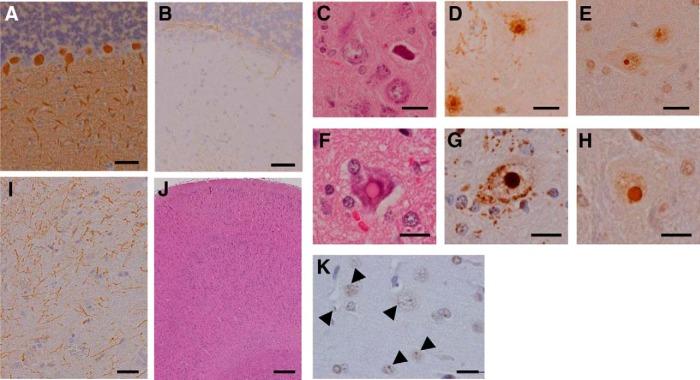 https://cdn.ncbi.nlm.nih.gov/pmc/blobs/fffa/5368386/32623120f928/enu0021722700007.jpg