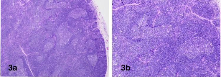 https://cdn.ncbi.nlm.nih.gov/pmc/blobs/fffe/8336297/8bfb783a9f9c/cureus-0013-00000016163-i03.jpg