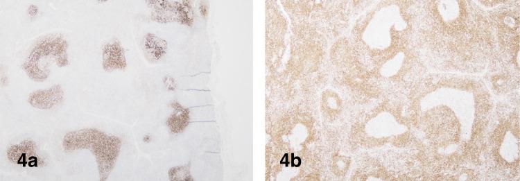 https://cdn.ncbi.nlm.nih.gov/pmc/blobs/fffe/8336297/eca3a94a2a82/cureus-0013-00000016163-i04.jpg